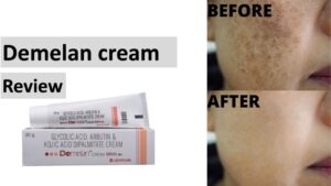 Read more about the article Demelan Cream : Does it effectively treat skin hyperpigmentation?