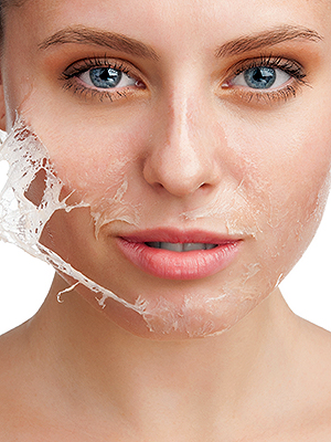 skin peeling 300x400 1 skin peeling 300x400 1